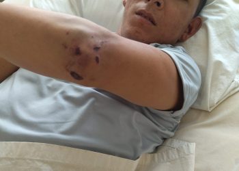 Marino agredido por su superior es evacuado a Lima en estado grave