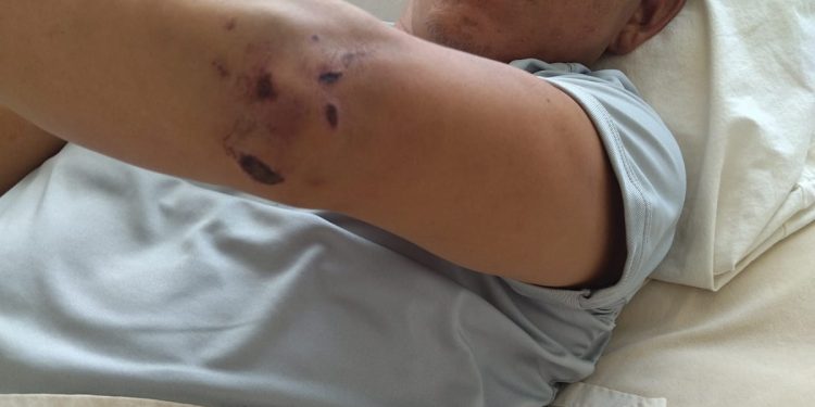 Marino agredido por su superior es evacuado a Lima en estado grave