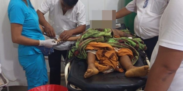 Menor de ocho años fallece tras mordedura de serpiente en Datem del Marañón