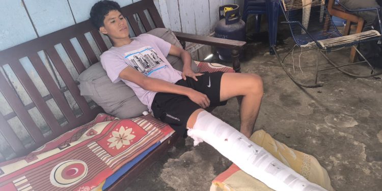 Joven universitario necesita cirugía de urgencia tras sufrir accidente de tránsito durante elecciones