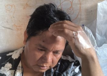 Pescador queda herido tras ser baleado por piratas del río en el Bajo Amazonas