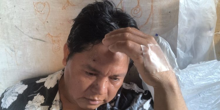 Pescador queda herido tras ser baleado por piratas del río en el Bajo Amazonas